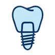 Implant Desteği
